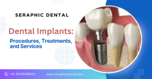 Dental Implants - Procedures, Treatments, and Services