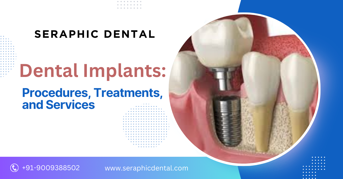 You are currently viewing Everything You Need to Know About Dental Implants: Procedures, Treatments, and Services