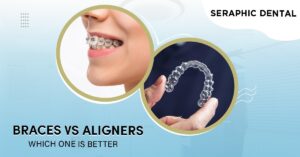 Read more about the article Clear Aligners vs. Metal Braces: Choosing the Best Option for Your Smile