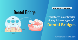 Benefits of dental bridges