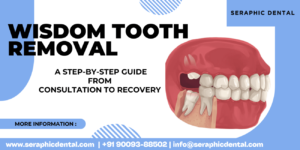 wisdom tooth removal