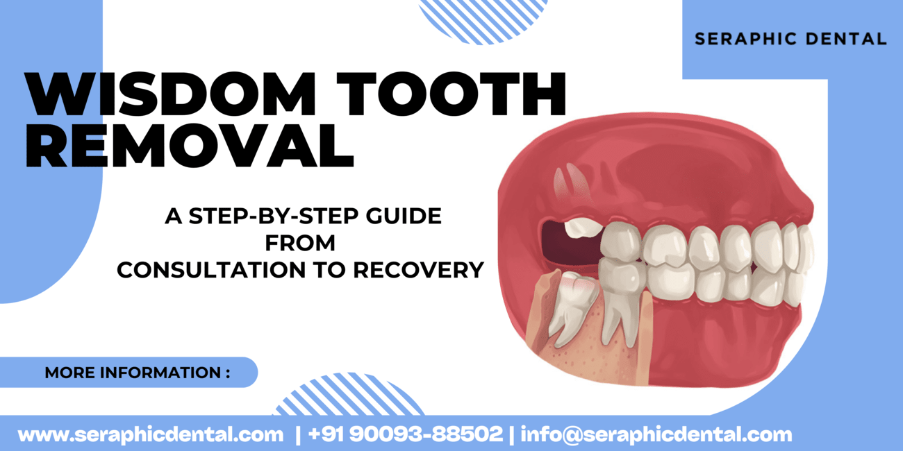 You are currently viewing Wisdom Tooth Removal: A Step-by-Step Guide from Consultation to Recovery