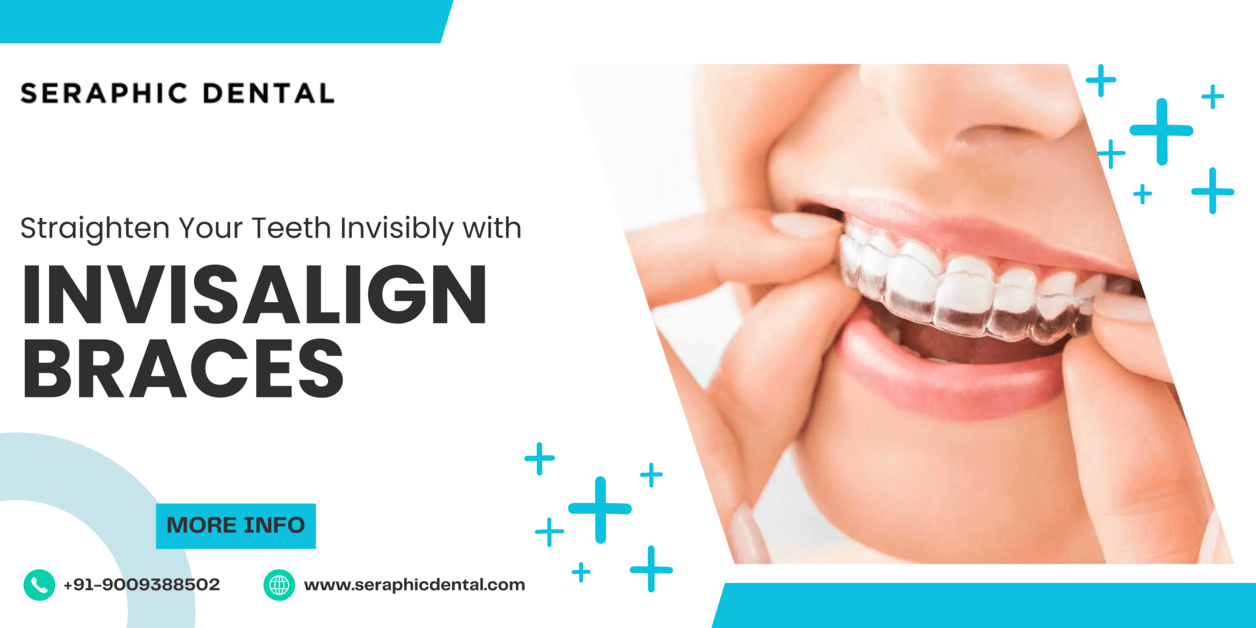 You are currently viewing Seraphic Dental: Straighten Your Teeth Invisibly with Invisalign Braces