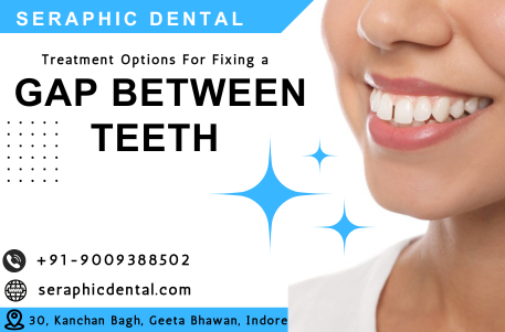 You are currently viewing Teeth Gaping treatment in Indore