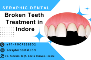 Read more about the article Broken Teeth Treatment: Restore Your Smile at Seraphic Dental Clinic, Indore