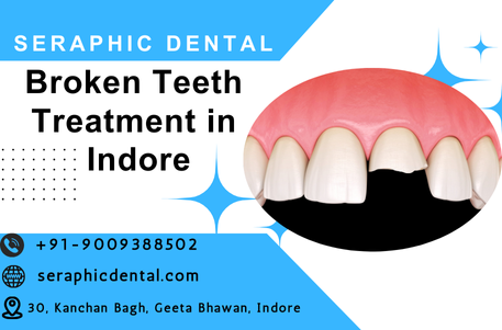 You are currently viewing Broken Teeth Treatment: Restore Your Smile at Seraphic Dental Clinic, Indore