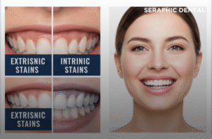 Best-Dental-Clinic-in-Indore