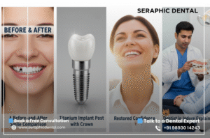 Missing-Teeth-_-Best-Dentist-in-Indore