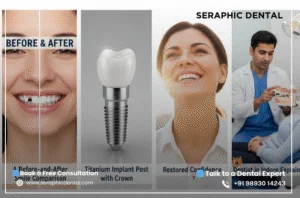 Missing-Teeth-_-Best-Dentist-in-Indore